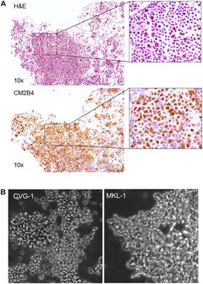 Characterization of a Merkel Cell Polyomavirus-Positive Merkel Cell Carcinoma Cell Line CVG-1